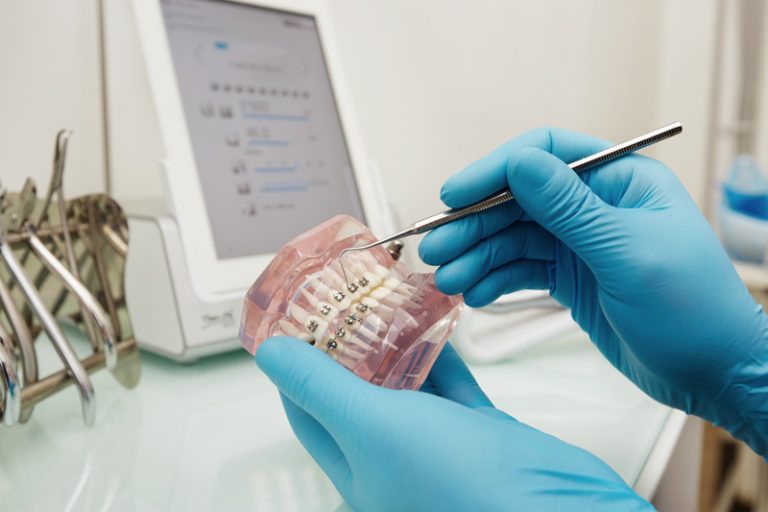 dentist-holding-dental-plastic-model-with-braces-(1)