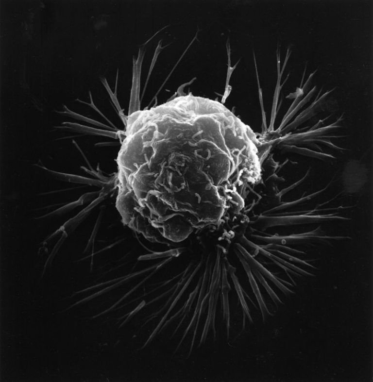 Breast_cancer_cell_(2)