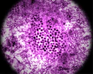 NIAID-west-Nile