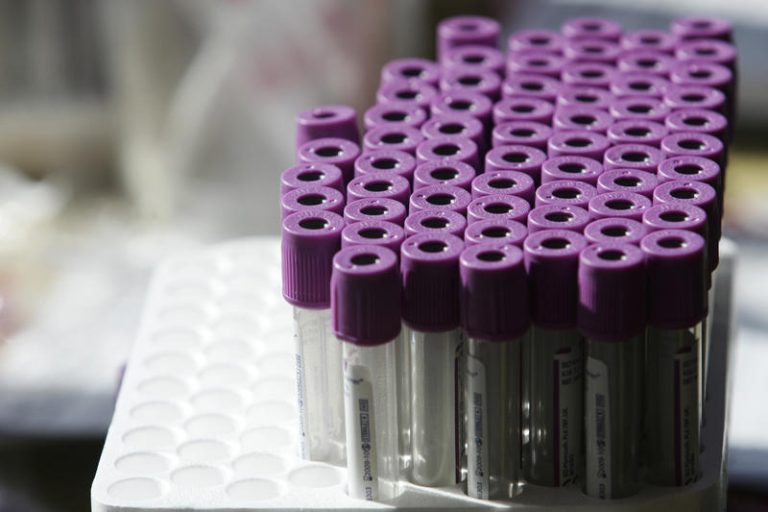 Test tube