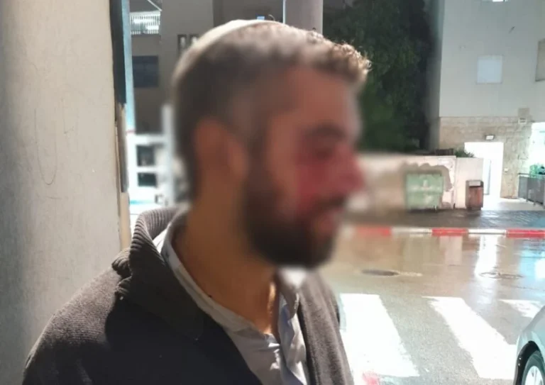 על רקע אנטישמי